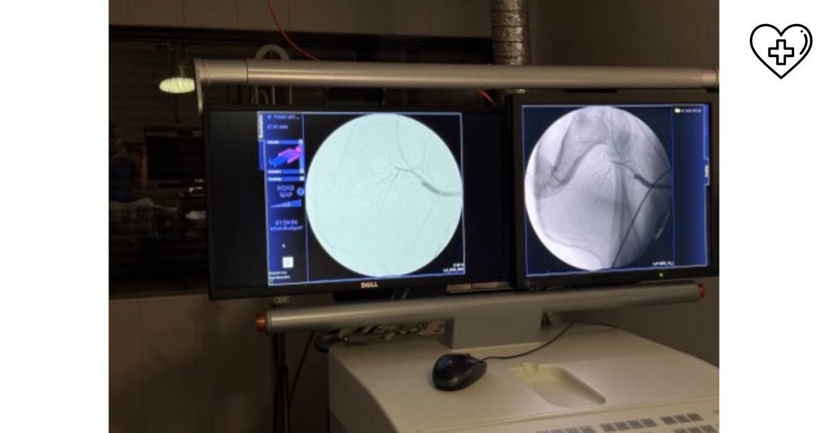 Более 850 малоинвазивных исследований сосудов сердца проведено пациентам юга области 