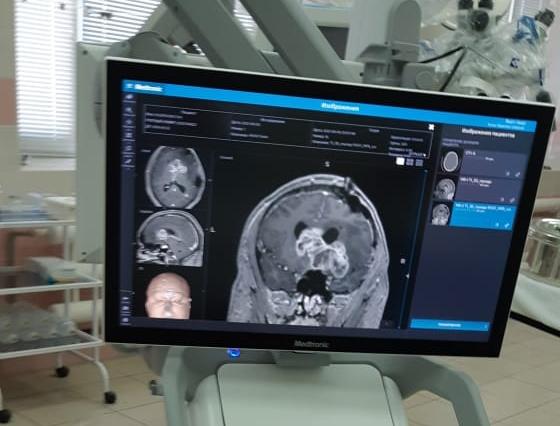 Нейрохирургическая навигационная система поступила в Нижегородскую областную клиническую больницу им. Н.А.Семашко Нейрохирургическая навигационная система поступила в Нижегородскую областную клиническую больницу им. Н.А.Семашко